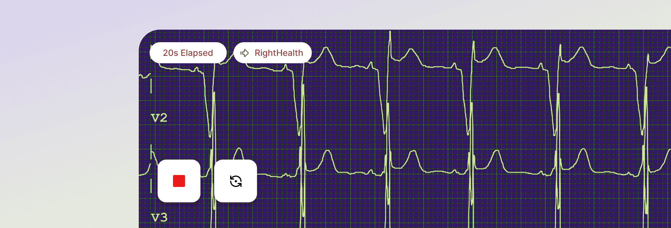 Introducing LVGL Safe: Building UIs for Mission-Critical Devices